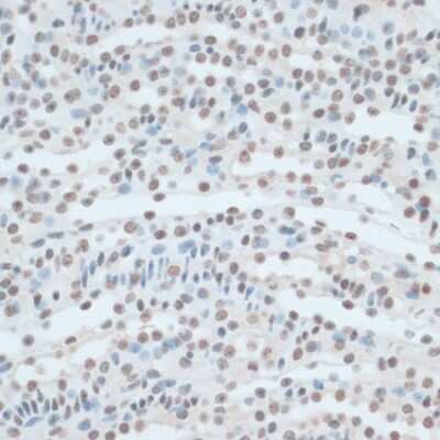 Immunohistochemistry-Paraffin: ZNF433 Antibody - Azide and BSA Free [NBP3-05110]